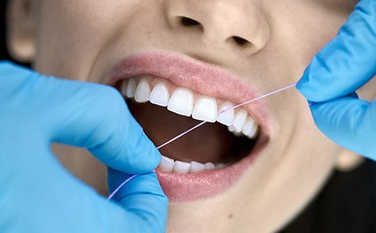 Dental hygienist flossing patient's teeth