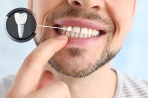 Man with a dental implant smiling